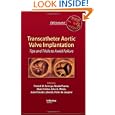 Transcatheter Aortic Valve Implantation: Tips and Tricks to... by Patrick W. Serruys, Alain Cribier Md, John Webb, and Jean-claude Laborde
