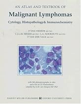 Atlas and Textbook of Malignant Lymphomas: Cytology, Histopathology & Immunochemistry