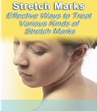 STRETCH MARKS! Various Kinds of Stretch Marks & Effective ways to Treat Them