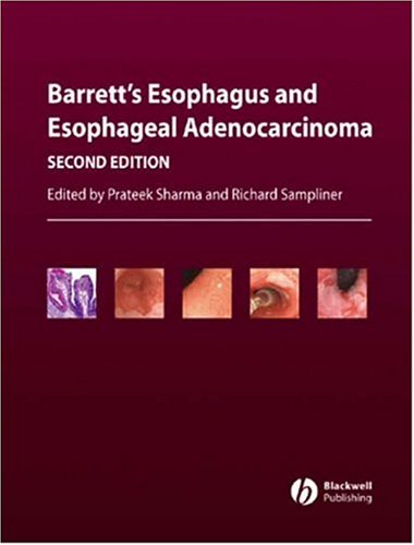 Conditions and Diseases