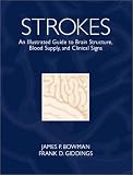 Strokes: An Illustrated Guide to Brain Structure, Blood Supply and Clinical Signs