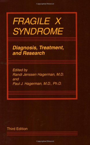fragile x syndrome