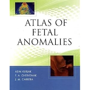 Click here to buy Atlas of Fetal Anomalies by Asim Kurjak.