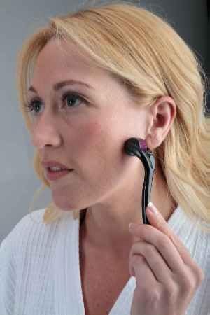 Derma Roller Titanium 540 Needles (3.0 mm) For Face And Body A Common Cosmetic Procedure That Stimulates Collagen and Elastin Production. Repairs * Aged Skin * Acne Scarring * Wrinkles * Stretch Marks * Cellulite