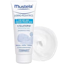 Mustela Dermo-Pediatrics, Stelatopia Moisturizing Cream 6.7 fl oz (200 ml)
From Mustela
