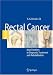 Rectal Cancer: New Frontiers in Diagnosis, Treatment and Rehabilitation 41Tghk2mMKL. SL75 Colon Cancer - The Maori Factor