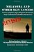 Melanoma and Other Skin Cancers: Causes, Symptoms, Signs, Diagnosis, Treatments, Stages of Melanoma and Other Skin Cancers