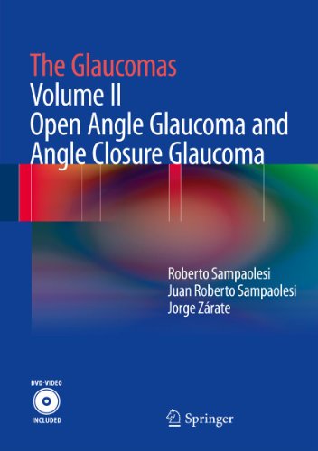 The Glaucomas: Volume II - Open Angle Glaucoma and Angle Closure Glaucoma: 2