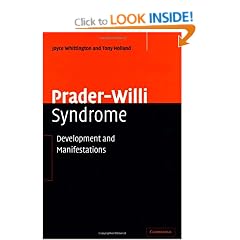 Prader-Willi Syndrome: Development and Manifestations