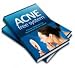 Acne Free System - Discover The Scientifically Proven Secrets To Permanently Removing Acne With Simple Home Based Treatments That Are Guaranteed To Work!