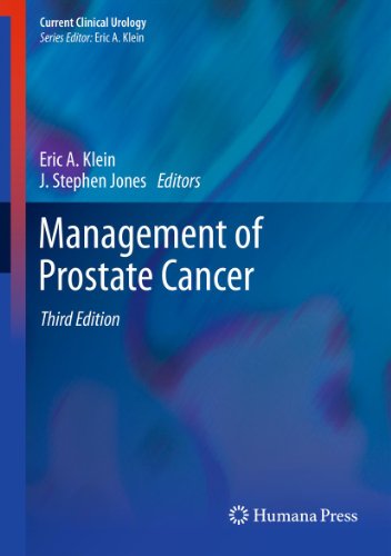 Management of Prostate Cancer (Current Clinical Urology)