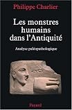 Les monstres humains dans l'Antiquit� : Analyse pal�opathologique