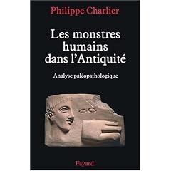 Les monstres humains dans l'Antiquit� : Analyse pal�opathologique