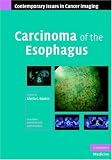 Carcinoma of the Esophagus (Contemporary Issues in Cancer Imaging)