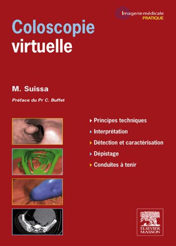 Coloscopie virtuelle (French Edition)