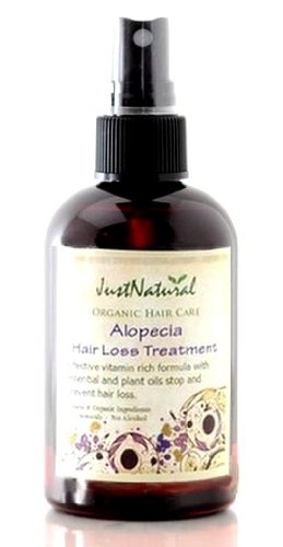 alopecia