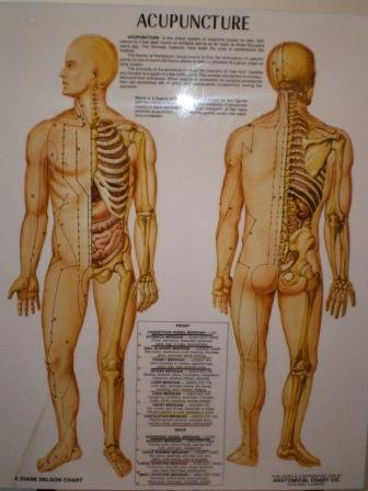 Acupuncture