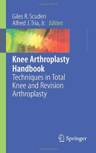 Knee Arthroplasty Handbook