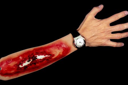 Imagen 1 de Brazo Gore - Hueso roto