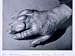 Dr. Atkinson's Frost-Bitten Hand, 1911 Art Photographic Poster Print by Herbert Ponti...