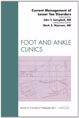 Current Management of Lesser Toe Disorders, An Issue of Foot and Ankle Clinics, 1e (The Clinics: Orthopedics)