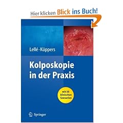Kolposkopie in der Praxis: mit 50 klinischen Szenarien