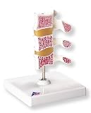 3B Scientific Deluxe Osteoporosis Model