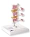 3B Scientific Deluxe Osteoporosis Model