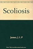 Scoliosis