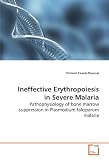 Ineffective Erythropoiesis in Severe Malaria: Pathophysiology of bone marrow suppression in  Plasmodium falciparum malaria