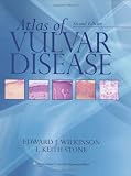 Atlas of Vulvar Disease