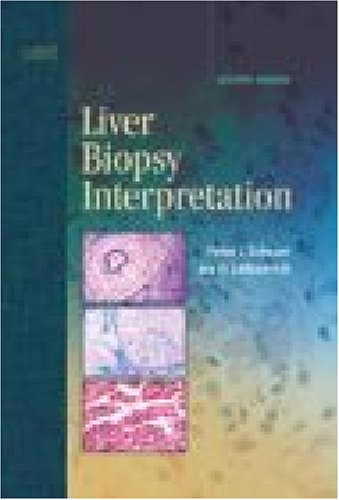 liver biopsy interpretation 7e major problems in pathology