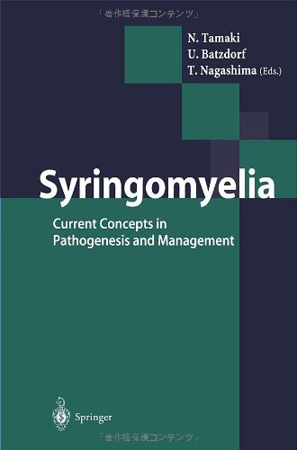 Syringomyelia: Current Concepts in Pathogenesis and Management