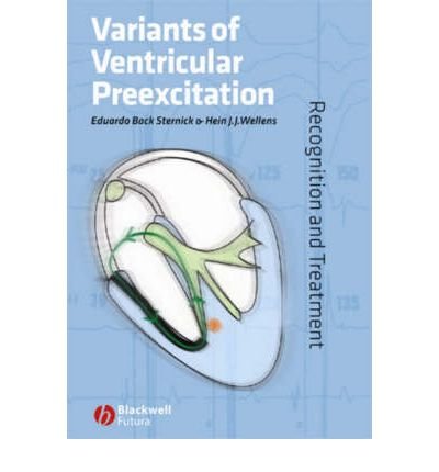 [(Variants of Ventricular Preexcitation: Recognition and Treatment)] [Author: Eduardo Back Sternick] published on (July, 2006), by Eduardo