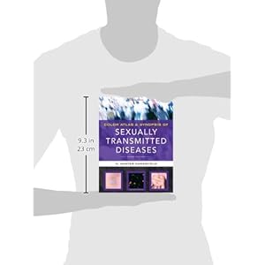 Color Atlas & Synopsis of Sexually Transmitted Diseases, Third Edition (Handsfield, Color Atlas & Synopsis of Sexually Transmitted Diseases)