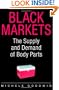 Black Markets: The Supply and Demand of Body Parts