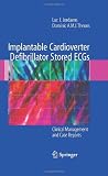 Implantable Cardioverter Defibrillator Stored ECGs: Clinical Management and Case Reports