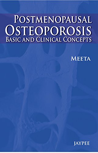 Postmenopausal Osteoporosis: Basic and Clinical Concepts