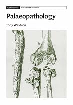 Palaeopathology (Cambridge Manuals in Archaeology)