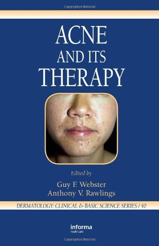 Acne and Its Therapy (Basic and Clinical Dermatology) On Sale