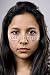 41Uw7dM%2BYCL. SL75  Acne Blemish