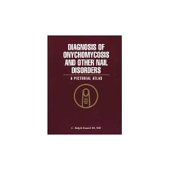Diagnosis of Onychomycosis and Other Nail Disorders: A Pictorial Atlas by C. Ralph Daniel
