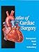 Search : Atlas of Cardiac Surgery (Books)