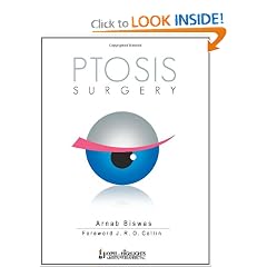Ptosis Surgery by Arnab Biswas and J. R. O. Collin