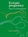 Book Ectopic Pregnancy: Diagnosis and Management