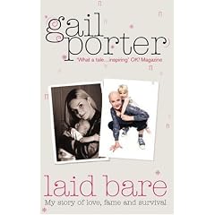 Laid Bare: My Story of Love, Fame and Survival
