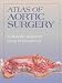 Search : Atlas of Aortic Surgery