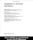 Implants in clinical dentistry