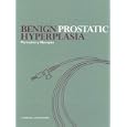 Benign Prostatic Hyperplasia by Perinchery, M.D. Narayan