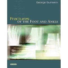 Fractures of the Foot and Ankle
